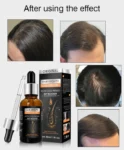 hair-growth-essential-oil-1699106314-65464e0a14bee.jpg